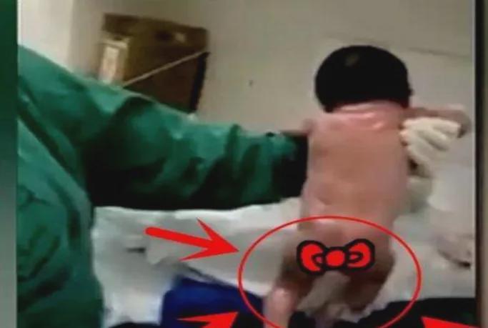 【医学科普】新生儿“撑杆跳”真相:从“最猛宝宝”看原始反射的生理机制与个体差异 健康养生